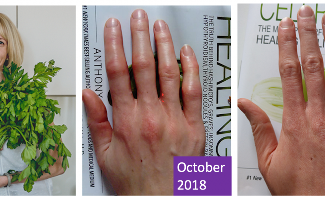 Healing gastrointestinal and inflammatory illness on a whole food plant-based diet