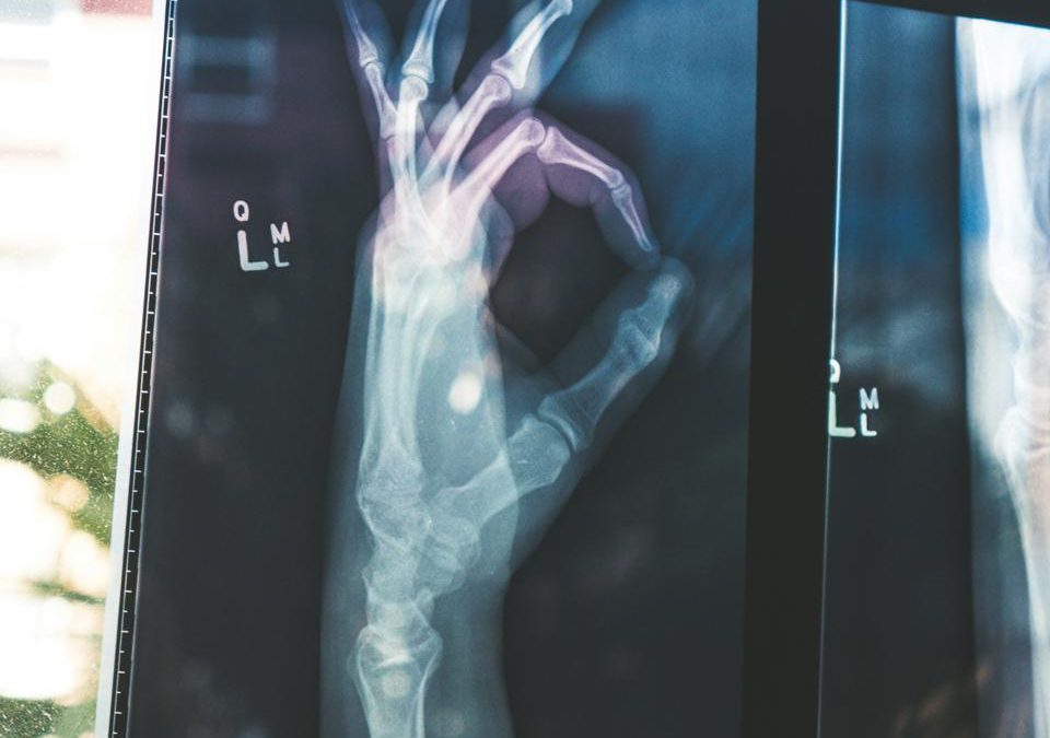 Plant-based diets and bone health