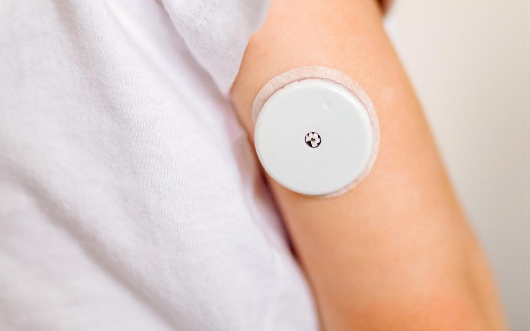 Should I wear a Continuous Glucose Monitor (CGM) to track my blood sugar?