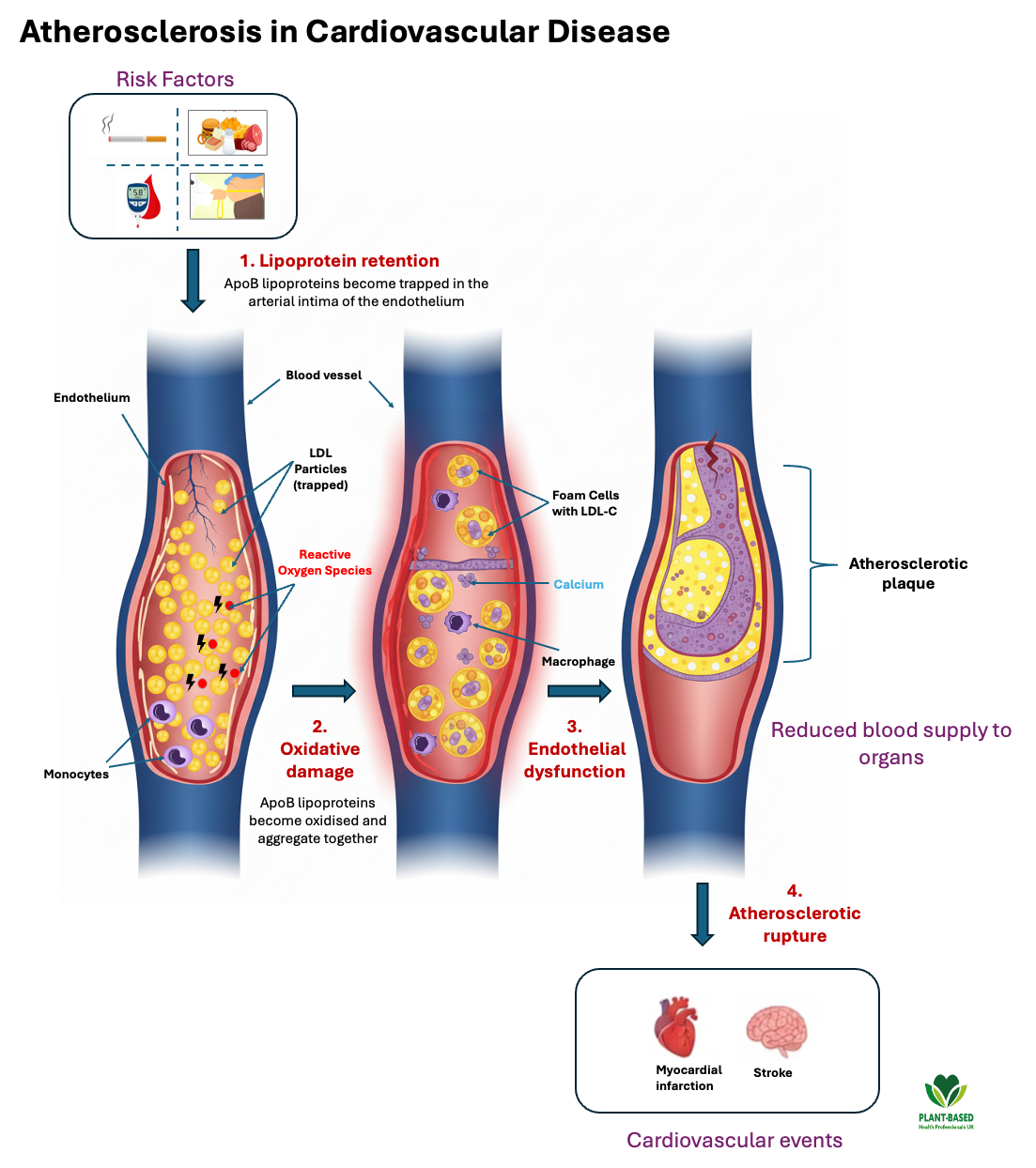 Atherosclerosis development in Cardiovascular Disease